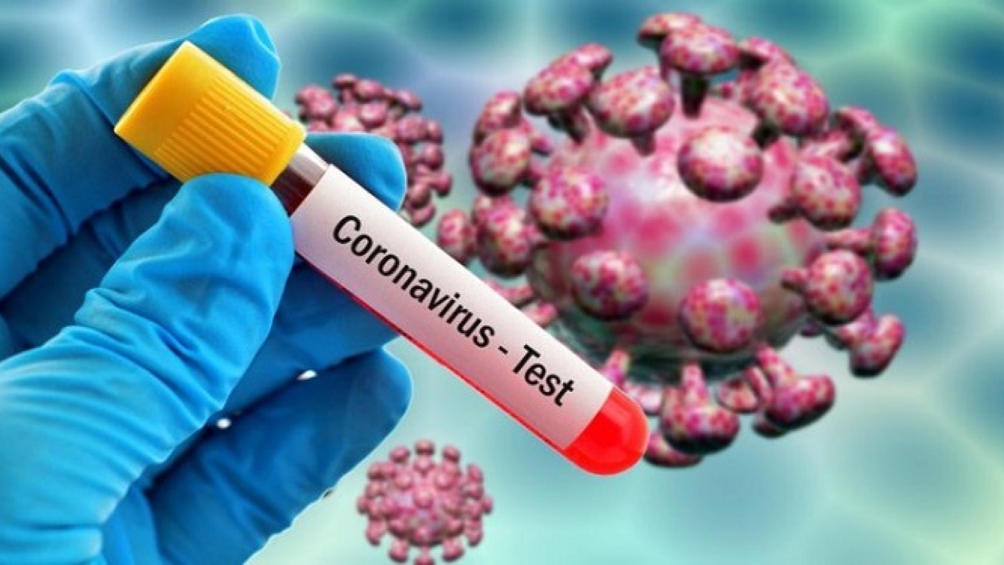 Coronavirus-testing