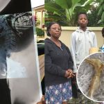 Miraculous Intervention In Boadua: Man Vomits Huge Bone
