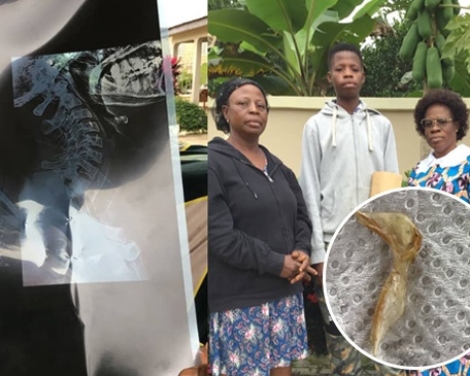 Miraculous Intervention In Boadua Man Vomits Huge Bone web